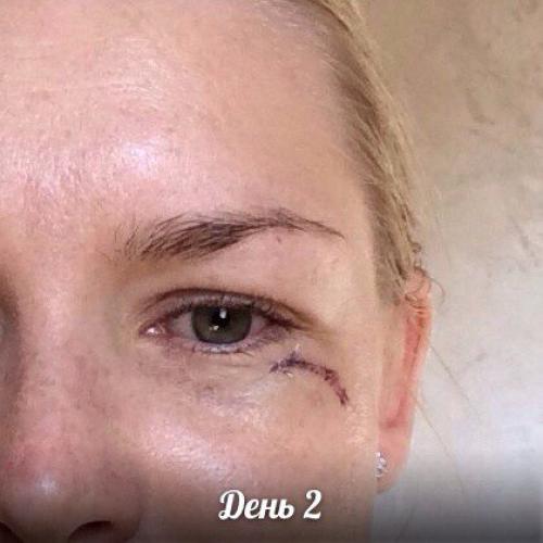 Средство которое должно в каждом доме быть! 03