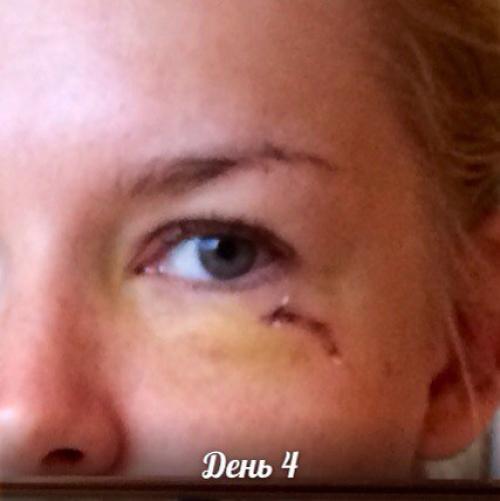 Средство которое должно в каждом доме быть! 04