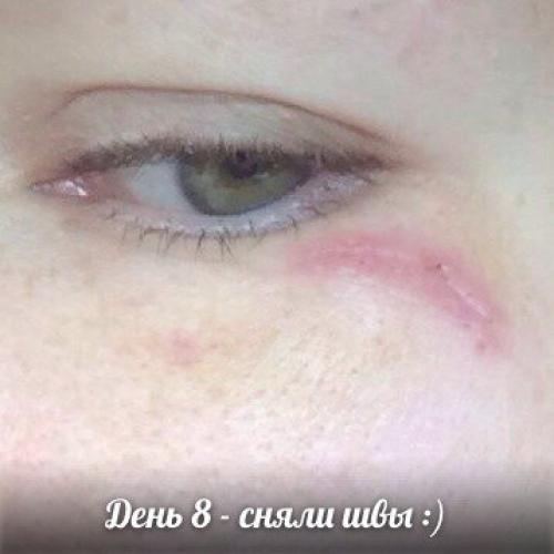 Средство которое должно в каждом доме быть! 06