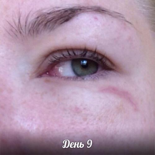 Средство которое должно в каждом доме быть! 07