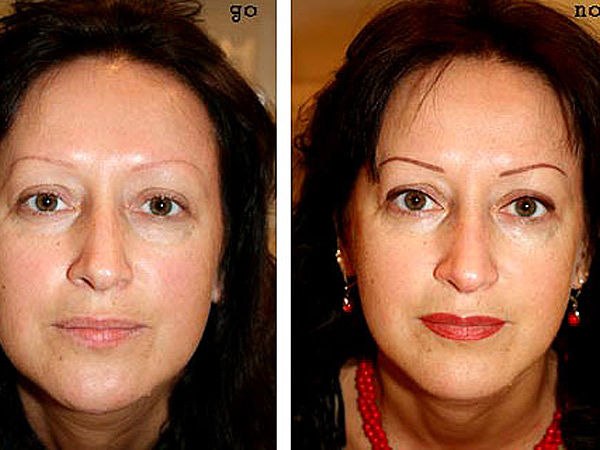 В пику возрасту. 02