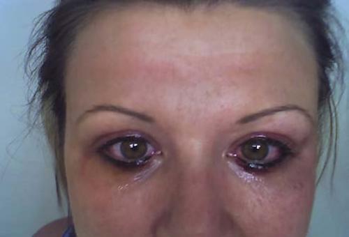 Очередные страсти мистер синяк. 02