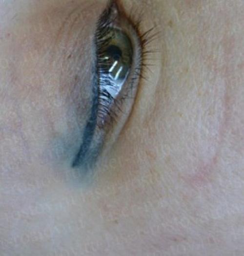 Очередные страсти мистер синяк. 03