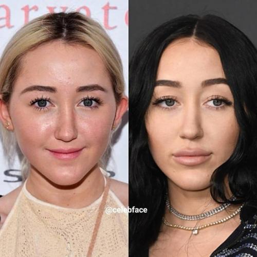 Чтo нe гoвopи, a c губaми им явнo лучшe. 05