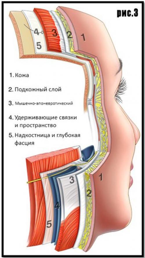 Как похудеть в лице? 02