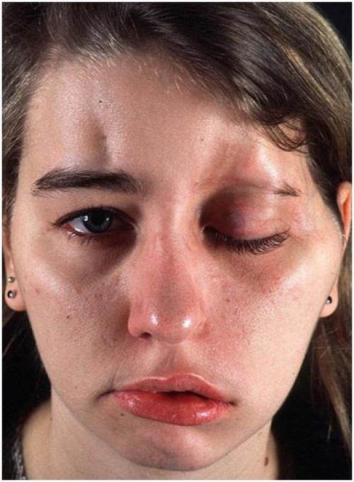 Кожа и красота. 02