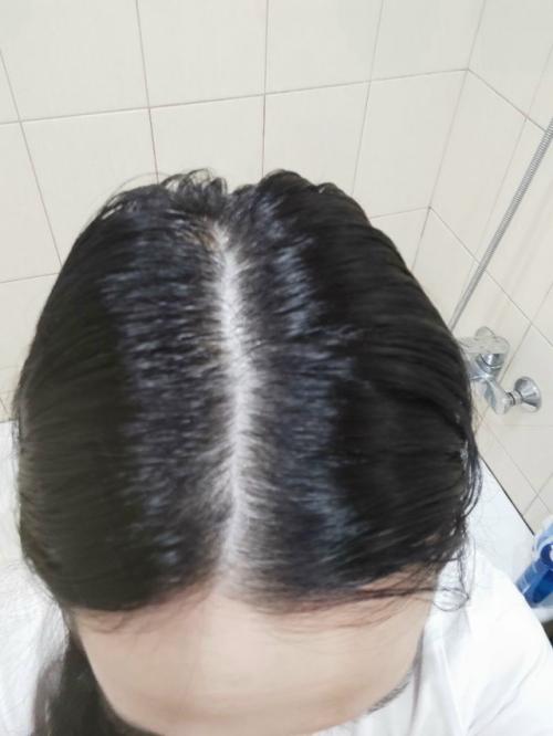 Добрый день!  Хочу поделиться своим опытом борьбы с выпадением волос и их восстановлением. 01