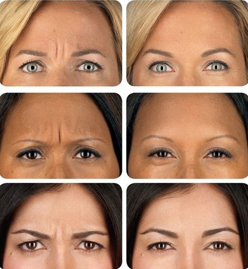 Прайс - лист проводимых процедур в студии Игла. 03