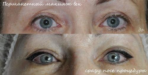 Воспользуйтесь скидкой на стрелочки 22, 23 и 24 ноября? 03 Воспользуйтесь скидкой на стрелочки 22, 23 и 24 ноября? 03