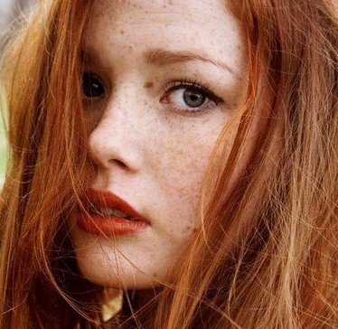 Веснушки в новом результате сбоя деятельности пигментной системы появляются. 01