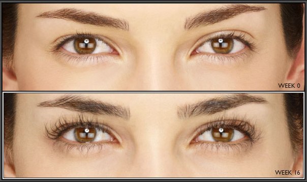 Карепрост – средство для интенсивного роста ресниц. 03