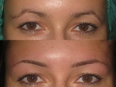 Не всех природа наградила красивыми и густыми бровями, то татуаж бровей может легко решить этот вопрос. 01