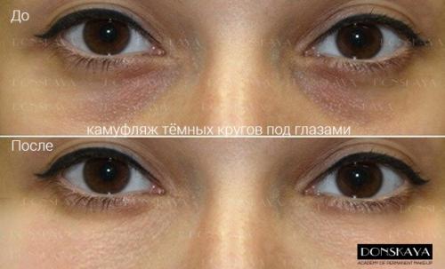 Татуаж вокруг глаз фото до и после