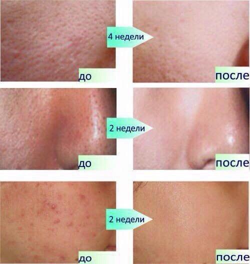 Мне было грустно? 01 Мне было грустно? 01