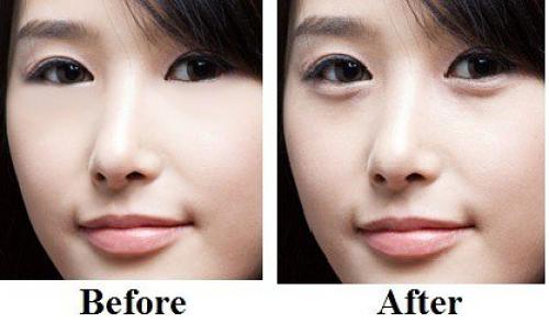 Никак не можешь избавиться от мешков под глазами? 04