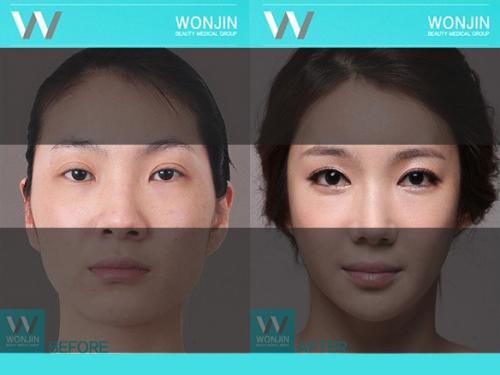 Никак не можешь избавиться от мешков под глазами? 03