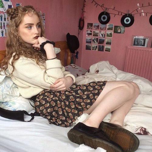 Что делать, если выпадают ресницы? 03