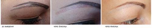 Внимание!  Вы хотите избавиться от неудавшегося перманентного макияжа? 05 Внимание!  Вы хотите избавиться от неудавшегося перманентного макияжа? 05