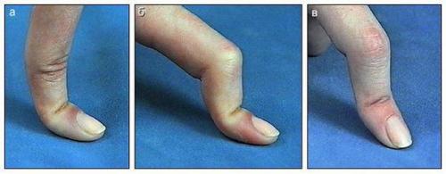 Мы лечим себя. 01