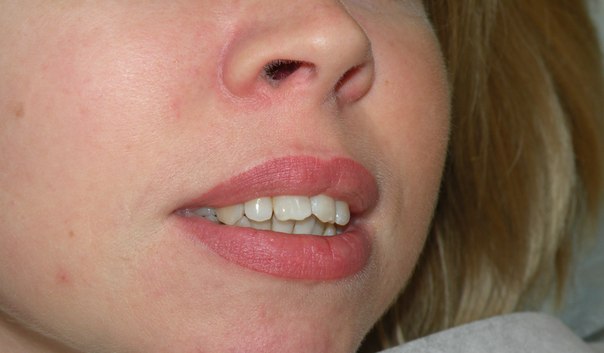 Перманентный макияж: Губы контур с растушевкой 6000 руб. 01