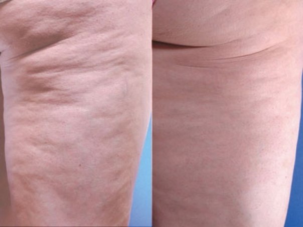 В жизни каждой женщины наступает день, когда собственный зеркальный двойник может довести до слёз. 04 В жизни каждой женщины наступает день, когда собственный зеркальный двойник может довести до слёз. 04