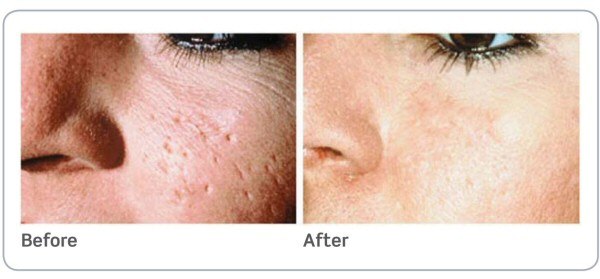 В жизни каждой женщины наступает день, когда собственный зеркальный двойник может довести до слёз. 02 В жизни каждой женщины наступает день, когда собственный зеркальный двойник может довести до слёз. 02