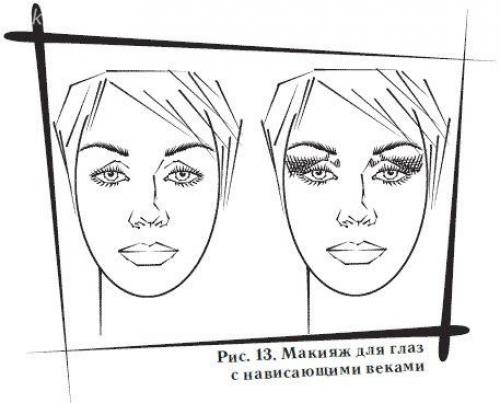 Нависшее веко - это когда над подвижным веком нависает его верхняя часть. 01 Нависшее веко - это когда над подвижным веком нависает его верхняя часть. 01