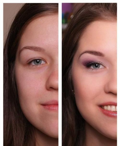 Нависшее веко - это когда над подвижным веком нависает его верхняя часть. 08 Нависшее веко - это когда над подвижным веком нависает его верхняя часть. 08