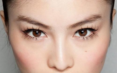 Нависшее веко - это когда над подвижным веком нависает его верхняя часть. 05 Нависшее веко - это когда над подвижным веком нависает его верхняя часть. 05