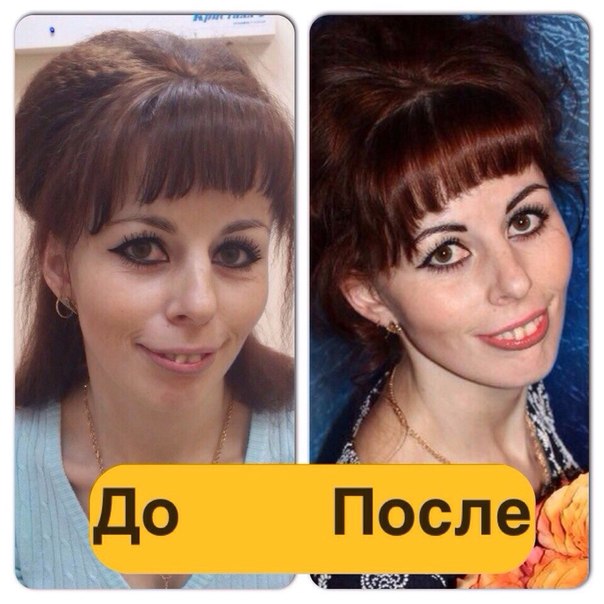 Хирургический медицинский центр Гиппократ предлагает большую услугу - контурный макияж или микропигментация (Long - Time - Liner). 02 Хирургический медицинский центр Гиппократ предлагает большую услугу - контурный макияж или микропигментация (Long - Time - Liner). 02