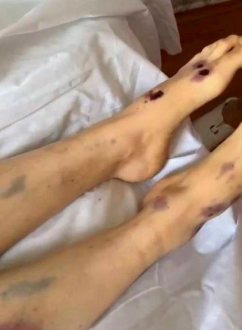 32-Летняя Айзат жанболат была обнаружена мёртвой с черепно-мозговой травмой, многочисленными переломами и следами повреждений на запястьях. 02