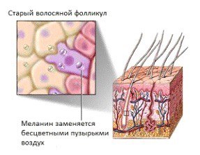 Что такое седина бороться и как с ней. 01 Что такое седина бороться и как с ней. 01