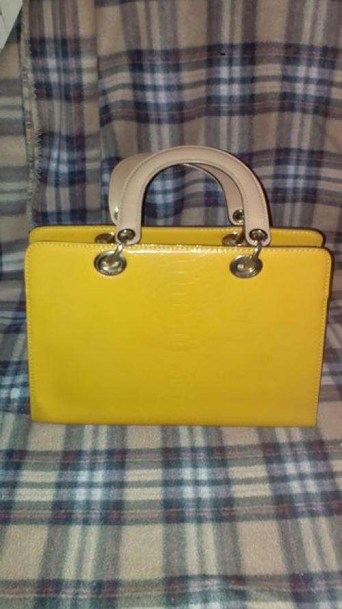 Обмен.  Желательно на окклюдеры как на первом фото, возможно у кого-то остались лишние или не подошли. 06