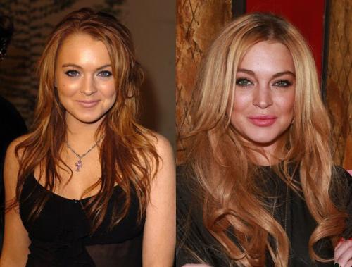 Что скрывать: звезды до и после пластики. 02