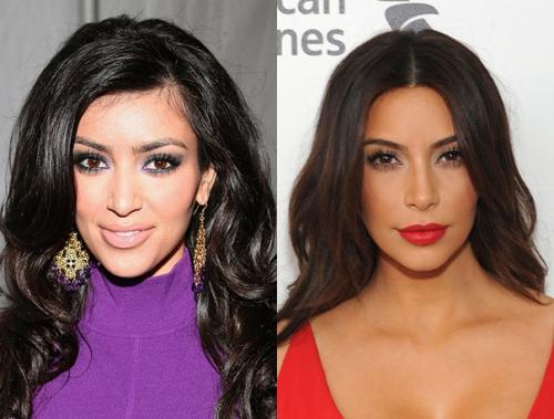 Что скрывать: звезды до и после пластики. 03