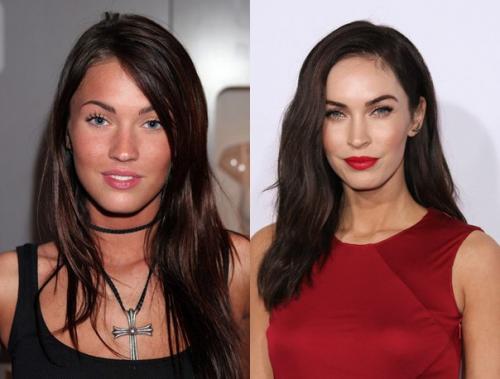 Что скрывать: звезды до и после пластики. 05